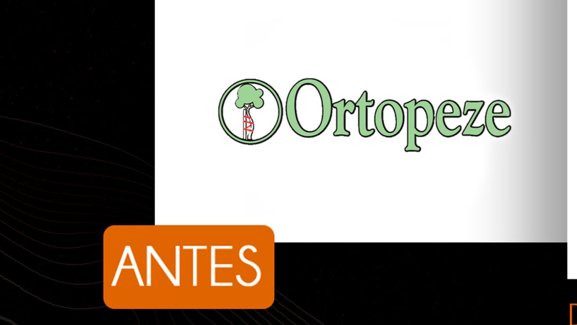 Ortopeze – 02